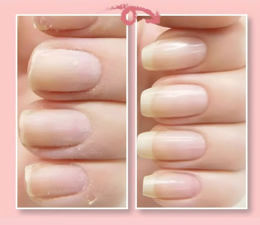 NailRevive™ | Gel riparatore per unghie incrinate (1+1 GRATIS)